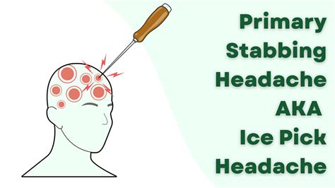 Primary Stabbing Headache aka Ice Pick Headache (symptoms, pathophysio ...