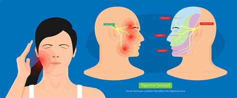 Trigeminal Nerve Examination