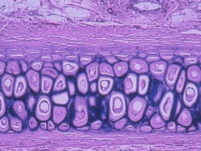 Cartilage Histology - Elastic cartilage-histology slide - | Histology ...