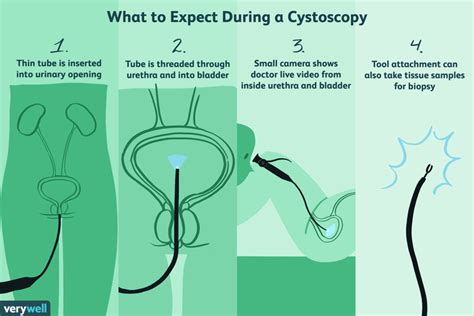 Cystoscopy: Uses, Side Effects, Procedure, Results