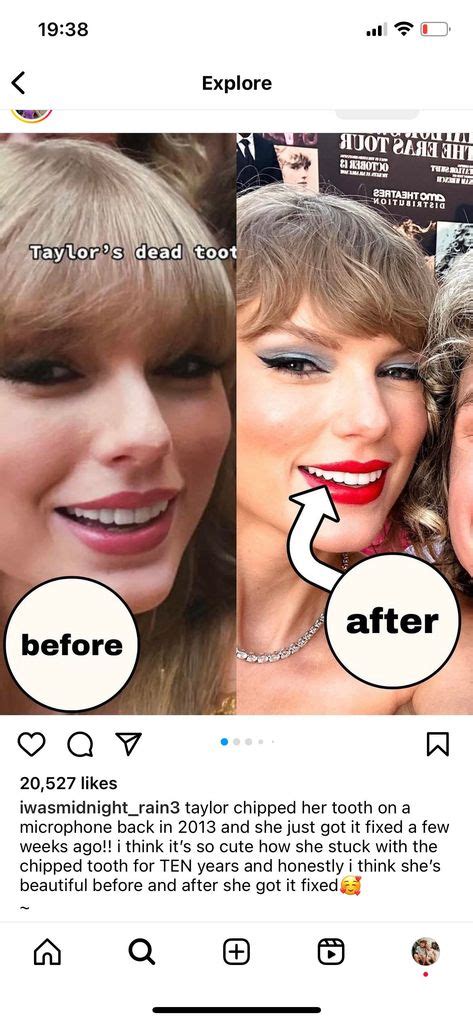 Taylor Swift's teeth transformation in before-and-after photos spark ...