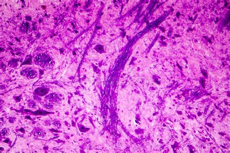 Spinal Cord Cross Section Histology Labeled