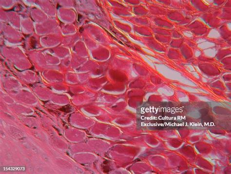 249 Epidermis Cells Stock Photos, High-Res Pictures, and Images - Getty ...