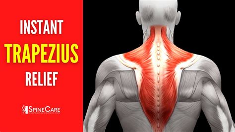 Trapezius Muscle Pain