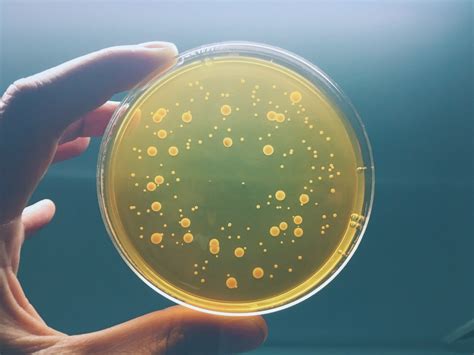 Aerobic Bacteria - Murray Brown Labs