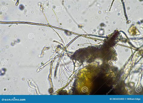 Fungal Hyphae Under The Microscope Royalty-Free Stock Photography ...