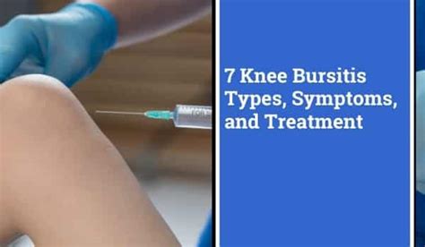 Knee Bursitis Symptoms Diagnosis Treatment | The Best Porn Website