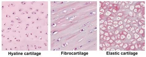 Elastic Cartilage Histology