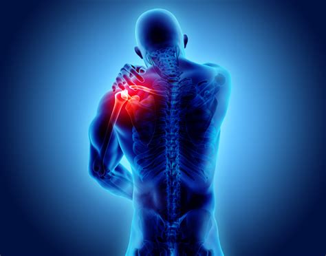 Shoulder Pain: Causes, Diagnosis, and Treatment - Southern Pain and ...