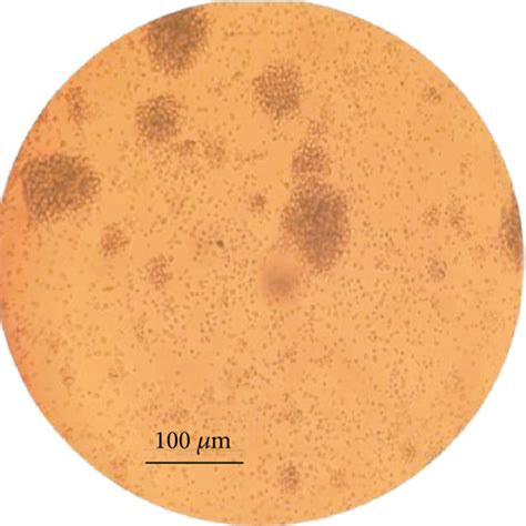 NK cell expansion. NK cell morphology in colony expansion (a). NK cell ...