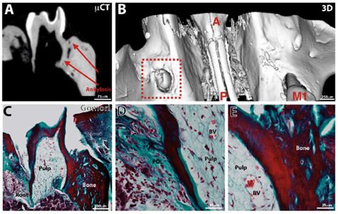 Observation of an ankylosed erupted bioengineered tooth.... | Download ...