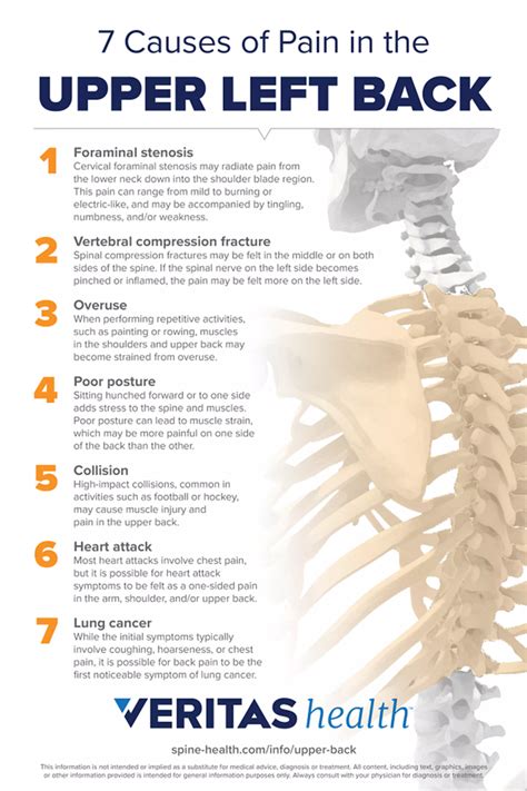 Upper Back Pain Symptoms | Spine-health