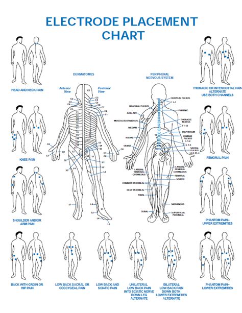 Tens Pad Placement Chart