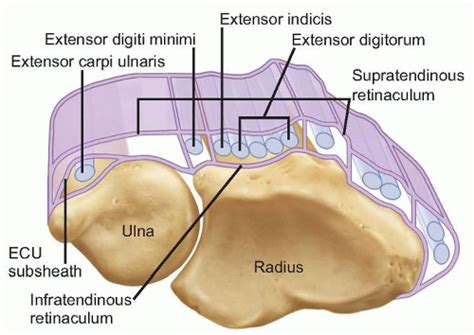 Extensor Carpi Ulnaris Subluxation