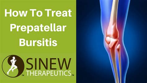 How To Treat Prepatellar Bursitis and Speed Recovery - YouTube