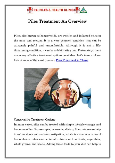 PPT - Piles Treatment-An Overview PowerPoint Presentation, free ...