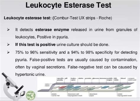 Leukocyte Esterase - Urine, What is?, Clinical Significance