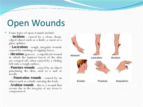 How to Describe a Wound Nursing - ZaidenkruwIngram