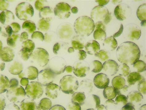 The Differences between a Protoplast and a Spheroplast (And Their ...