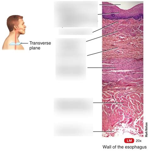 Esophagus Diagram | Quizlet