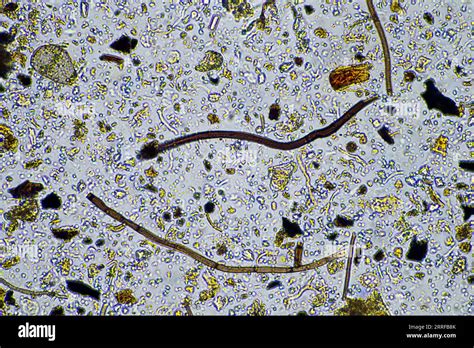 Fungal and fungi hyphae under the microscope in the soil and compost ...