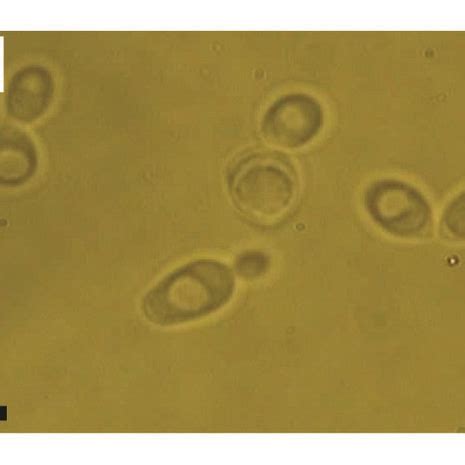 The morphology of the spheroplast W303 cells inside four different ...