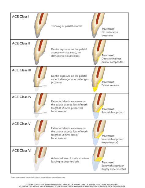 Edentulous alveolar ridge denture classification - onlykera