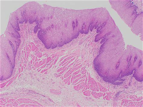 Esophagus Histology