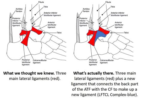 torn ankle ligament surgery the hammer and the nail effect