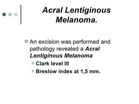 Acral lentiginous melanoma