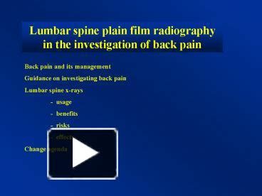 PPT – Lumbar spine plain film radiography in the investigation of back ...