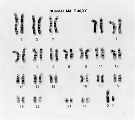 Karyotype — Knowledge Hub