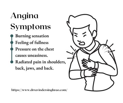 Angina: Symptoms, Causes Treatment, 49% OFF | rbk.bm