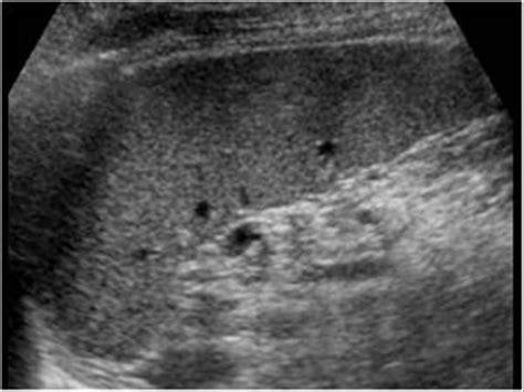 Abdomen and retroperitoneum | 1.4 Spleen : Case 1.4.4 Miscellaneous ...