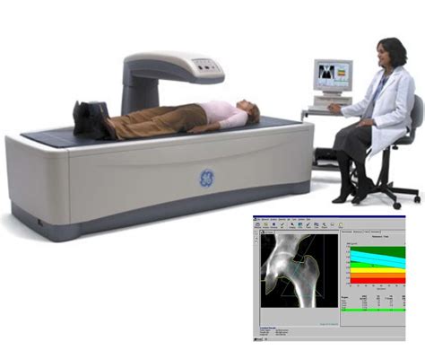 Bone Density Testing Near Me,Viera Fl, and Suntree Fl – Viera ...