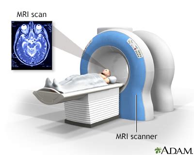 Mri Scan Brain Procedure