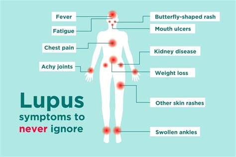 Signs and Symptoms of Lupus – Lupus Association of NSW Inc.