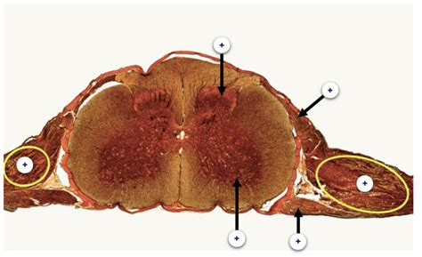 Spinal Cord Cross Section Histology Diagram | Quizlet