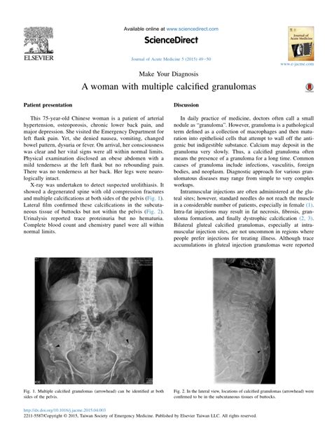 (PDF) A woman with multiple calcified granulomas