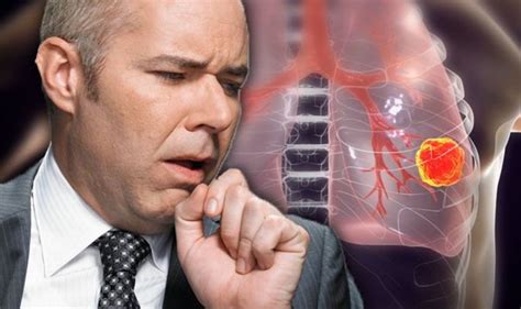 Lung cancer symptoms: Signs of tumour you need treatment include a bad ...