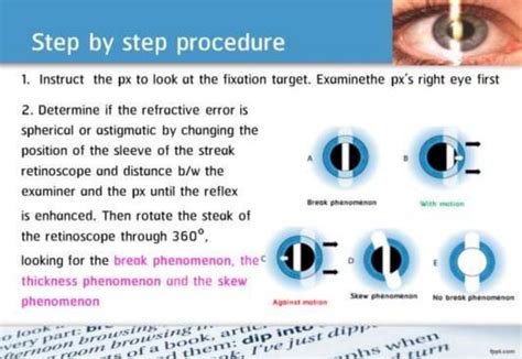 21 step-Diagnosis Procedure Refraction