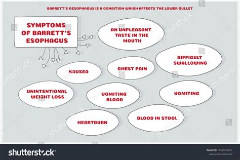 Symptoms Barretts Esophagus Vector Illustration Medical Stock Vector ...