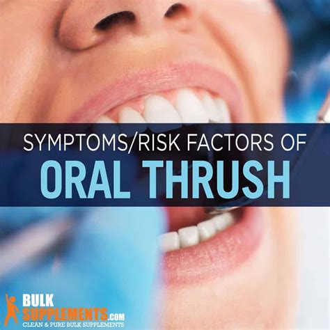 Oral Thrush: Symptoms, Causes & Treatment