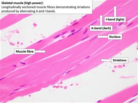 Skeletal Muscle – Normal Histology – NUS Pathweb :: NUS Pathweb