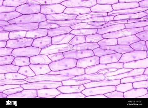 Epidermis Plant Cells