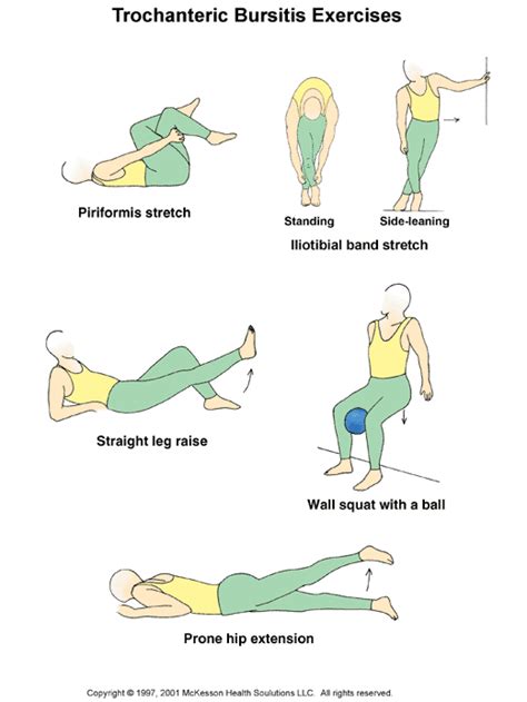 trochanteric bursitis exercises pdf spanish - Kori Callaway