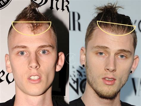 Mgk Hair