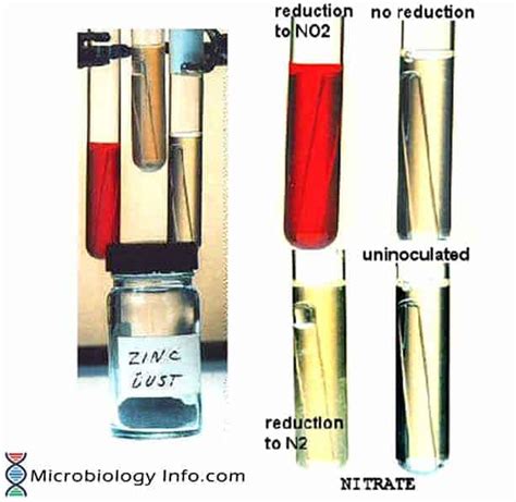 Nitrate Reduction Test Principle Procedure Uses And Interpretation ...