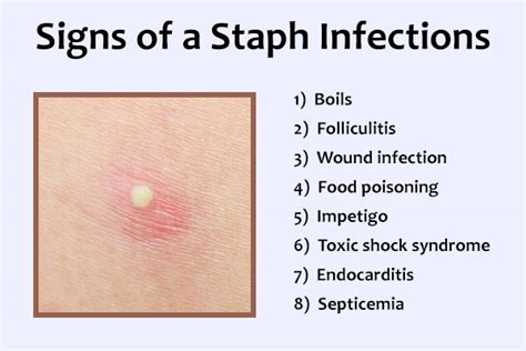 How To Cure A Staph Infection - Amountaffect17