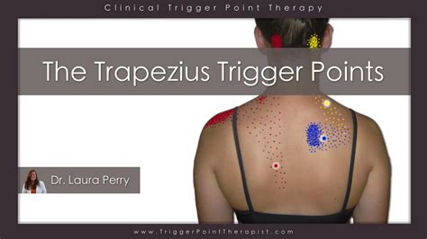 Trapezius Trigger Points Are Like Opinions, Everyone Has One ...